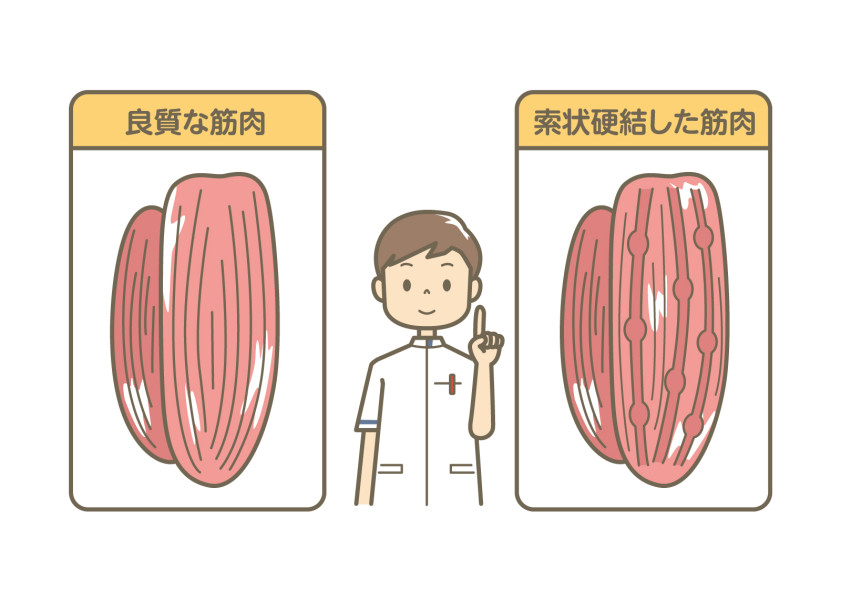 筋肉の説明